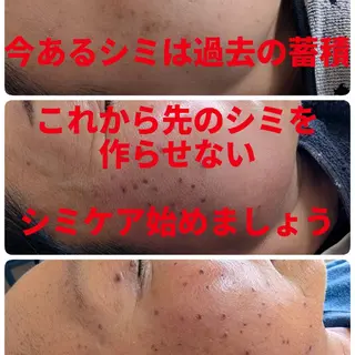 SPOT.com  シミケア専門店のエステ・リラクイメージ