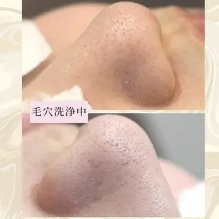 ANRIRE (アンリール)のエステ・リラクイメージ