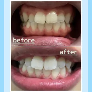 メンズ お手軽ホワイトニングsalon mina所属・武元 奈津美のその他イメージ