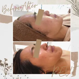 温活beautyサロンNeroli所属・切らない脂肪吸引🔥 Neroliまりこのエステ・リラクイメージ