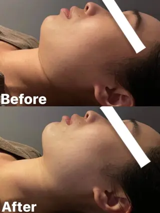 ハイフ・小顔・骨盤 シャングリラのエステ・リラクイメージ