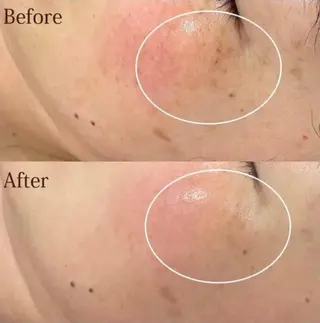 【folche】 フジイのエステ・リラクイメージ