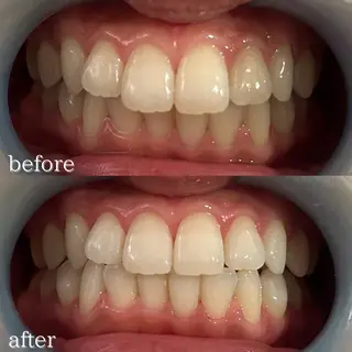 【Beauel】 あげはのエステ・リラクイメージ