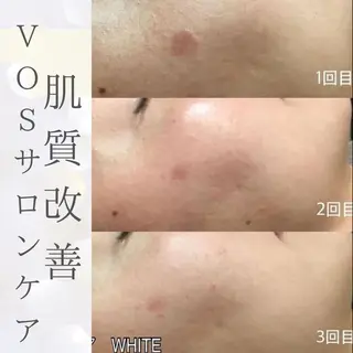 Purua beuty所属・月1肌管理 RINAのエステ・リラクイメージ