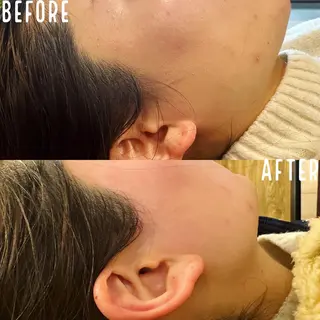 KOHOLA -ワックス脱毛専門-のエステ・リラクイメージ