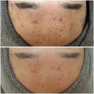 艶肌デトックス🫧 Samiraのエステ・リラクイメージ