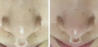 Kanunu所属・鶴橋エステ kanunuのエステ・リラクイメージ