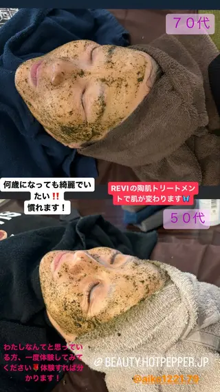 ハーブピーリング/韓国肌管理/フェイシャル/毛穴洗浄/眉毛/顔脱毛【糸脱毛専門】rev所属・ハーブピーリング🌹 毛穴洗浄❤️眉waxのエステ・リラクイメージ