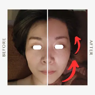 鍼灸サロンmiyabi所属・美容鍼×エステ　鍼灸 サロンmiyabiのエステ・リラクイメージ