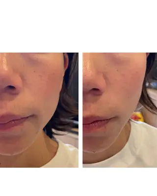 美容鍼灸サロン   colorier所属・美容鍼灸サロン colorierのエステ・リラクイメージ