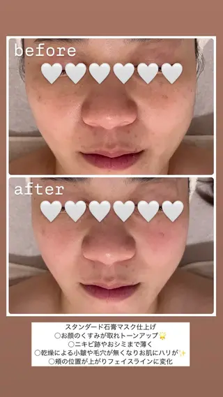 POLA THE BEAUTY 堺東店所属・肌管理🌿毛穴改善 POLA堺東のエステ・リラクイメージ