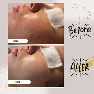 ピーリング専門店 Belluteのエステ・リラクイメージ