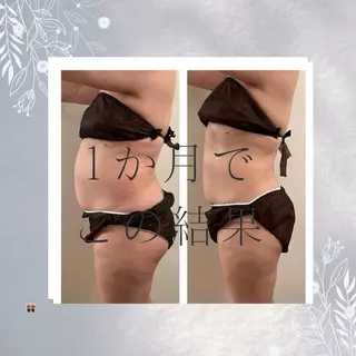 Relative ララティブのエステ・リラクイメージ