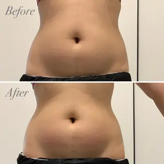 R.M所属・プライベートサロン R.Mのエステ・リラクイメージ