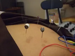 銀座そうぜん鍼灸院所属・不妊鍼灸専門 吉田ナミのエステ・リラクイメージ