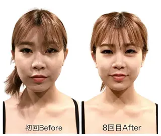 小顔•美容矯正Bholic所属・小顔・骨格矯正 Bholic 日本橋のエステ・リラクイメージ