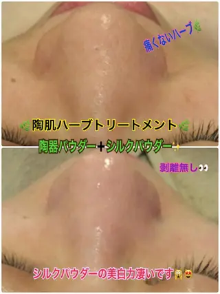 【リベルハーブピーリング認定店】敏感肌・美白脱毛専門店Dione立川店所属・Dione 立川店のエステ・リラクイメージ