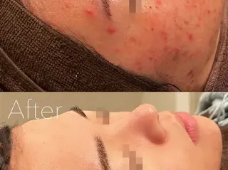 韓国肌管理Belle 神戸元町のエステ・リラクイメージ