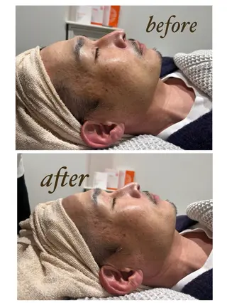 柳川 瑠花のエステ・リラクイメージ