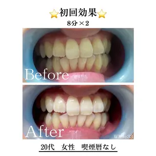 セルフホワイトニング White33大名のその他イメージ