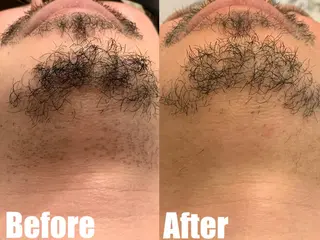 メンズ 都度払い脱毛ブレア /代々木のエステ・リラクイメージ