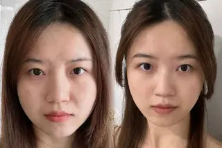 aliaハイフ&水光ジェットサロン所属・aliaハーブ水光店 エステティシャン募集のエステ・リラクイメージ