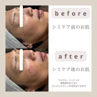 emiluka beautyのエステ・リラクイメージ