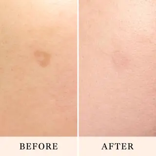 シミ・肌育サロン Jullyのエステ・リラクイメージ