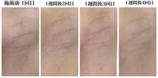 ビューティー ミロワールのエステ・リラクイメージ