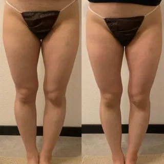 【コスパ最強痩身】 GRANDIRのエステ・リラクイメージ