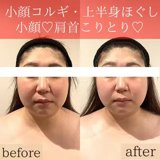 こりとりコルギ専門店MIICO所属・こりとりコルギ専門店 勝　友里奈のエステ・リラクイメージ