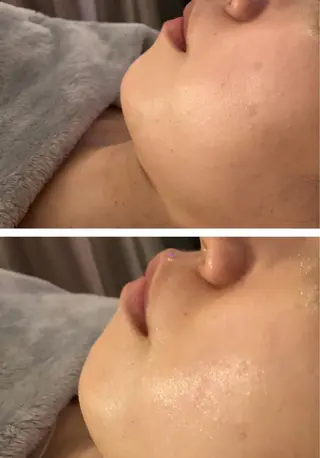 エステfreep takamoriのエステ・リラクイメージ