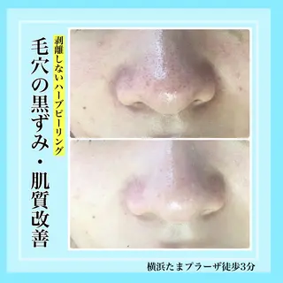 LILIANA所属・LILIANA ☆YURIのエステ・リラクイメージ