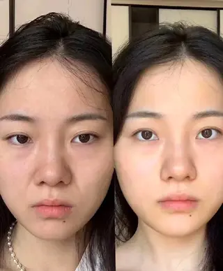 aliaハイフ&水光ジェットサロン所属・aliaハーブ水光店 エステティシャン募集のエステ・リラクイメージ