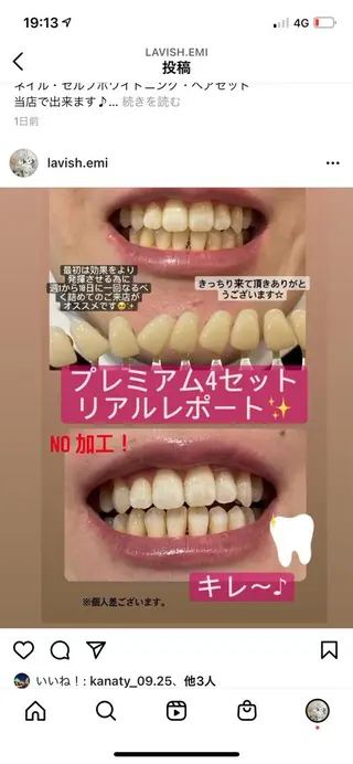 LAVISH nail salonのネイルデザイン