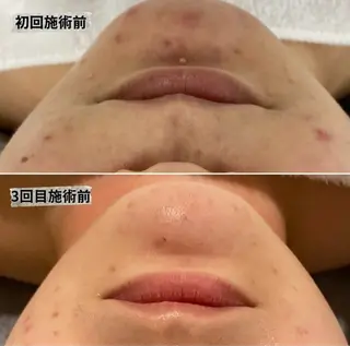 Re Amply Minamiのエステ・リラクイメージ