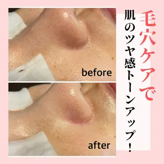 ピーリング専門店 Belluteのエステ・リラクイメージ