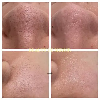 マツエク・マツパ ビューティー ミロワールのエステ・リラクイメージ