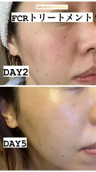 美顔秘密基地新宮所属・美顔秘密基地 新宮のその他イメージ