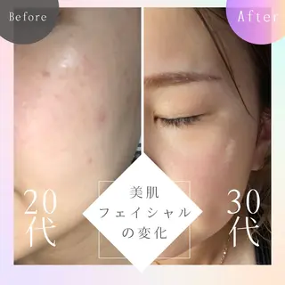 美肌脱毛と癒しのﾌﾟﾗｲﾍﾞｰﾄｻﾛﾝ。gratia~ｸﾞﾚｲﾃｨｱ~所属・gratia ~ｸﾞﾚｲﾃｨｱ~のエステ・リラクイメージ