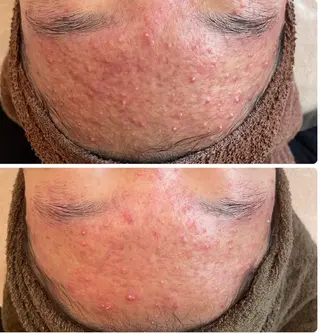 LOUISE.所属・LOUISE. ／ネイルのネイルデザイン