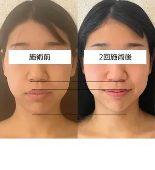 小顔/たるみ/黒ずみ除去専門サロン/SONA 大和西大寺店所属・【小顔専門看護師 サロンSONA】のエステ・リラクイメージ