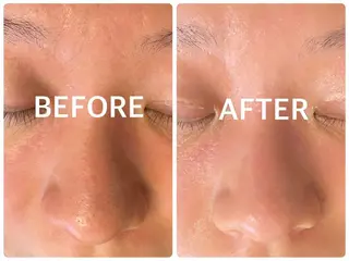 ハーブピーリング 横浜のエステ・リラクイメージ