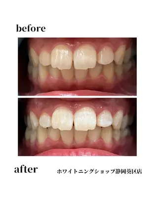 ホワイトニングショップ静岡葵区店所属・ホワイトニング ショップ葵区静岡駅店のその他イメージ