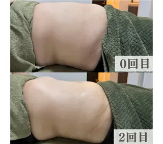 小顔・健康美専門店 Coputa所属・こりとり＆小顔 コルギ　専門店のエステ・リラクイメージ