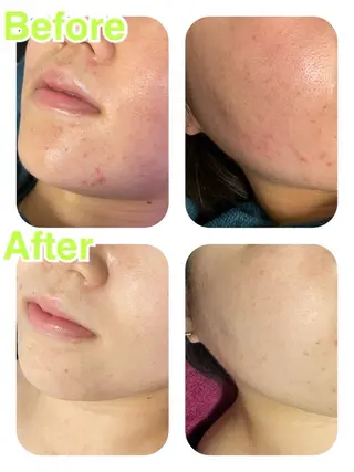 skin make salon -Olu's-所属・毛穴・肌質改善サロン ✨Tomaのその他イメージ