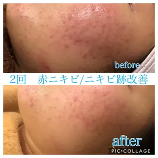 ロング カラー パーマ ヘアアレンジ メンズ キッズ ネイル マツエク・マツパ Ensor Clair所属・EnsorClair 代表　野口真央のエステ・リラクイメージ