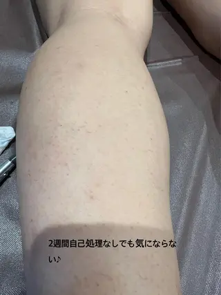 メンズ キッズ クラスペディア脱毛 ・フェイシャル専門店のエステ・リラクイメージ