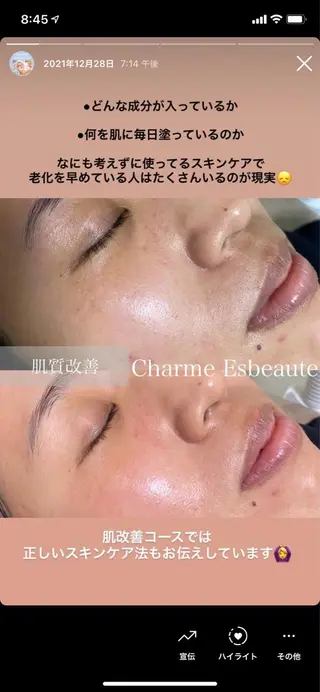 Charme Esbeaute所属・南森町 ｃｅのマツエク・マツパデザイン