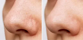 BAUM. 宮村のエステ・リラクイメージ